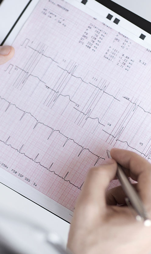 A medical professional analyses the Electrocardiogram (ECG) report.