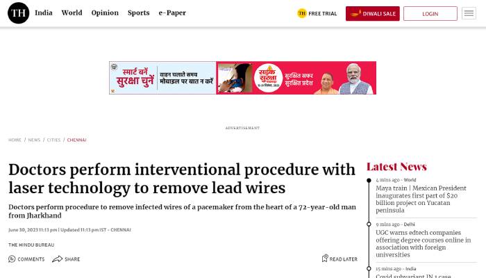 Online news article in The Hindu on Doctors performing interventional procedures with laser technology to remove lead wires.